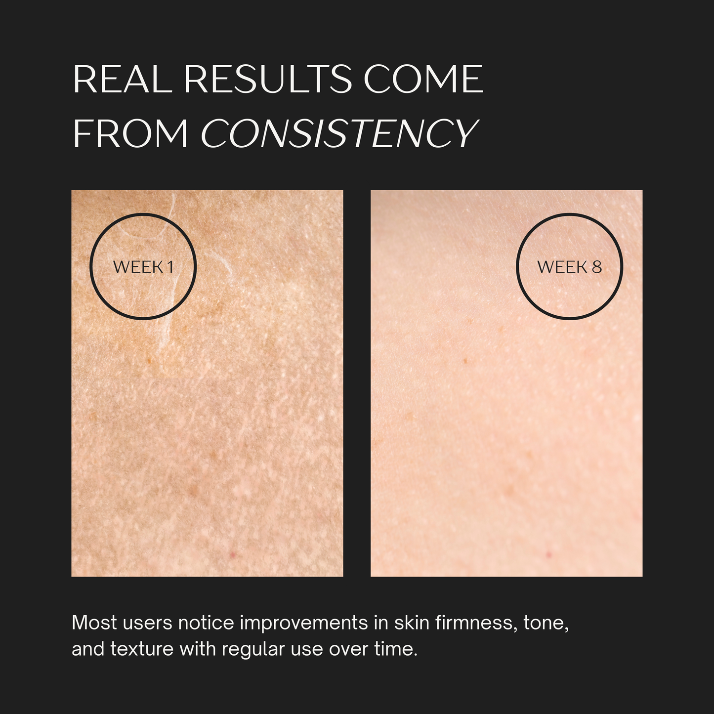 AHURO™ Neck & Face Sculptor V2