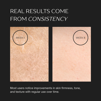 AHURO™ Neck & Face Sculptor V2